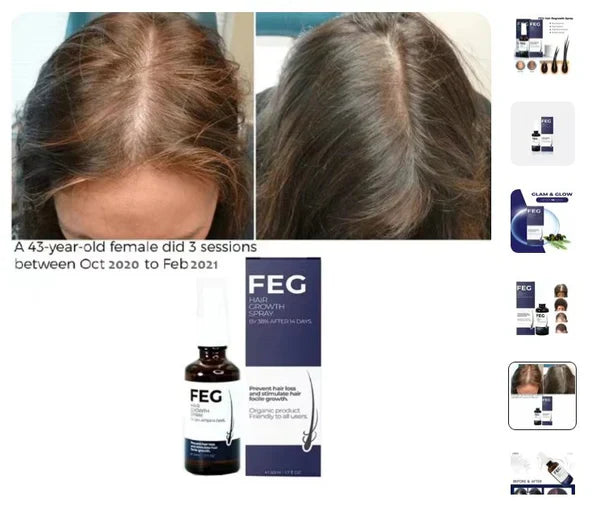 FEG Organic Hair Growth Treatment Oil